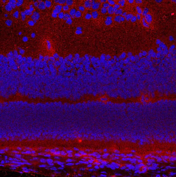IF of a mouse retina labeled with DSHB antibody AFFN-KDM6B-7E10 against Lysine(K)-specific demethylase 6B (red). Image credit: Lachke Lab, University of Delaware.